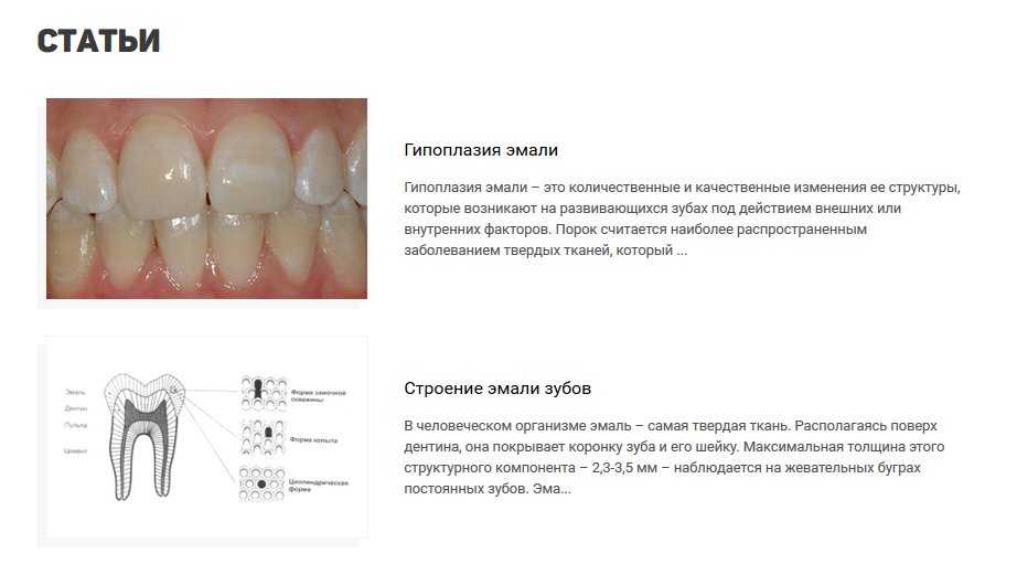 Статейный блок на сайте стоматологической клиники